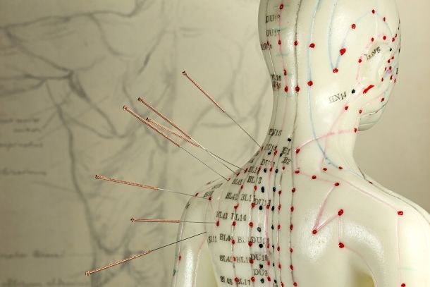 acupuncture-services-los-angeles
