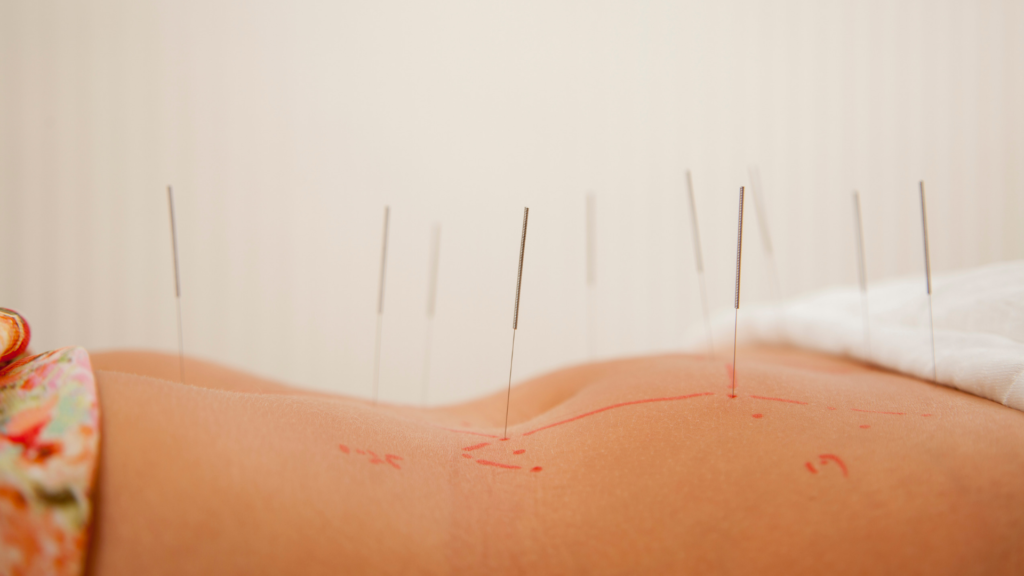 acupuncture and menstrual cycle